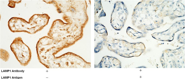 LAMP1 Antibody in Immunohistochemistry (Paraffin) (IHC (P))